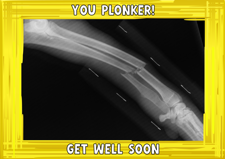Get well soon yellow swirl border photo upload Sponge Cake Topper